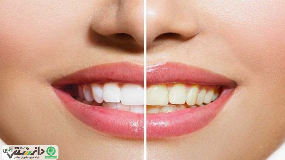 هرآنچه برای داشتن دندان های سالم نیاز دارید