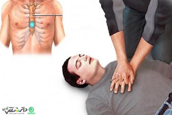 آموزش کمک های اولیه به مصدومین در تصادف +ویدئو