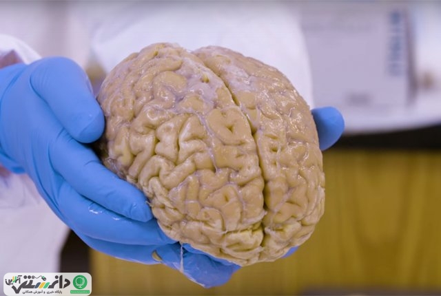 دعوت از مردم برای اهدای مغز به بانک مغز انسانی