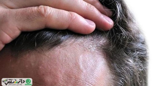 چند توصیه کاربردی بهداشتی و تغذیه ای برای سلامتی