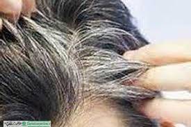 استرس تنها دلیل سفیدی مو نیست