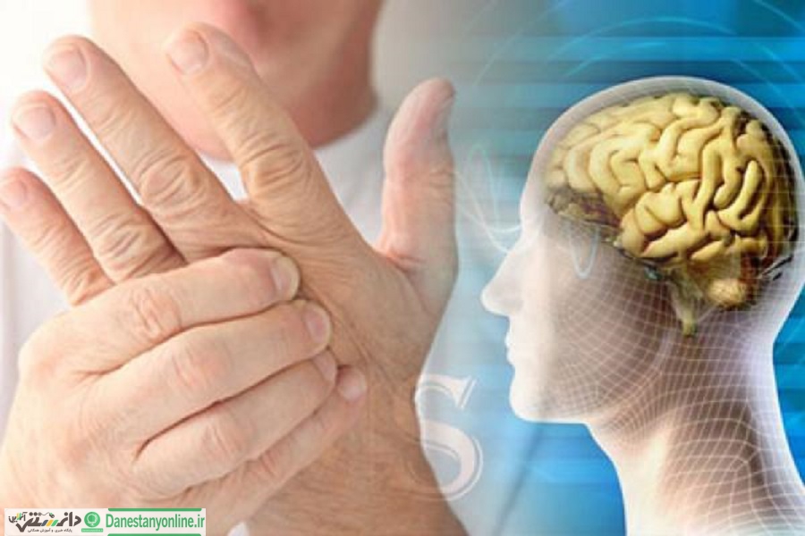 ام اس و تاثیرآن برزندگی فرد مبتلا