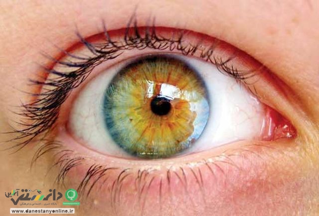 آنچه چشم ها درباره سلامتی افراد می گویند