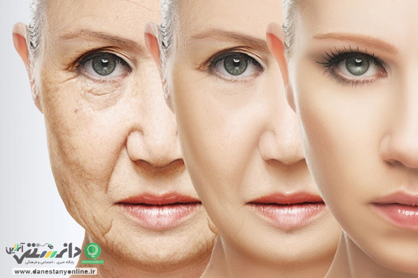 برخی از چین و چروک ها نشانه بیماری در بدن است