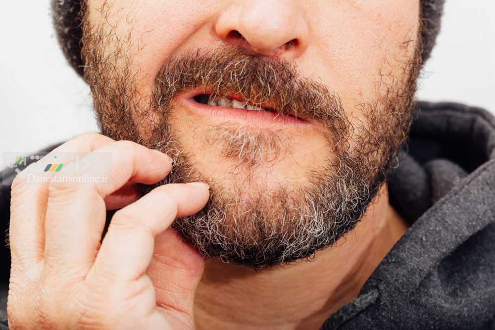 دانستنی مردان/ برای خارش ریش چه کنیم؟