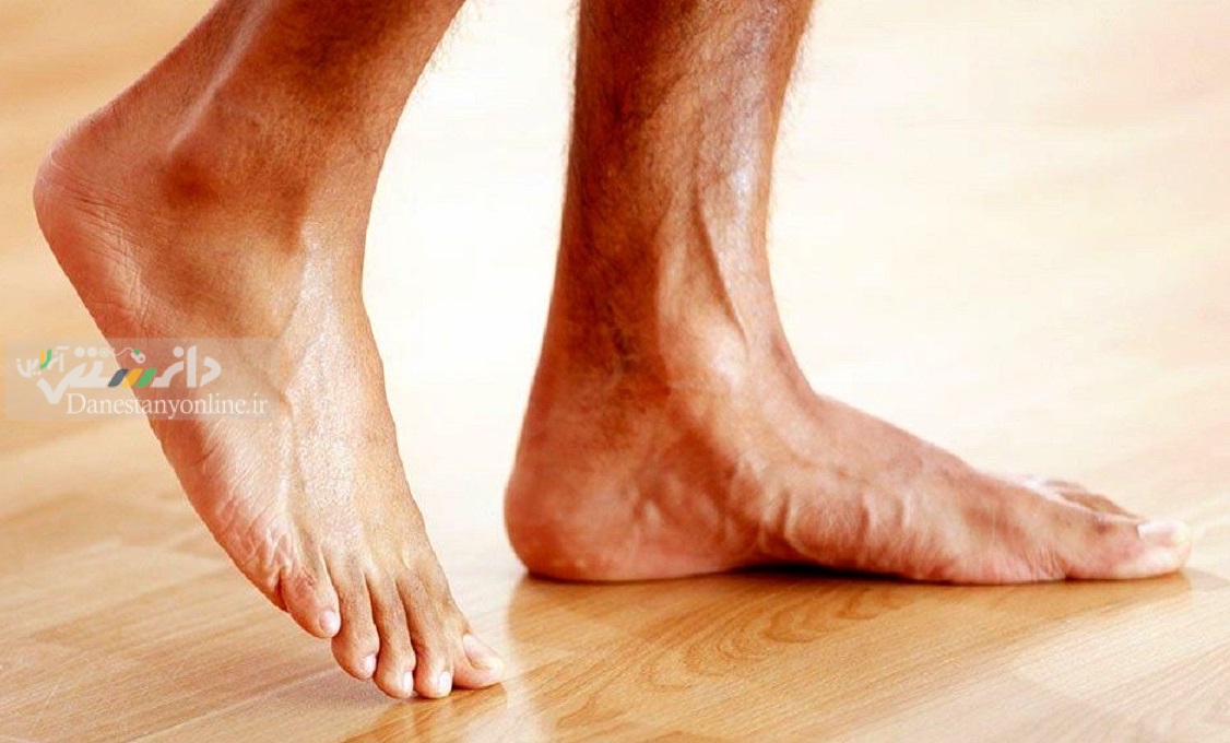 دانستنی سلامت/ ۶ توصیه مهم برای سلامت پاها