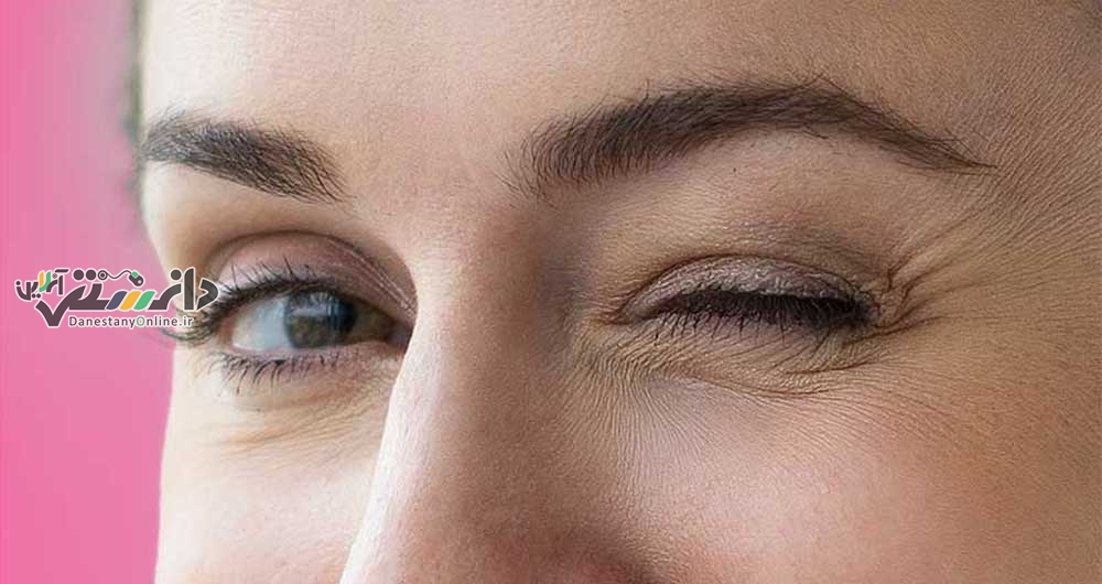 دانستنی سلامت/مهمترین دلایل لرزش پلک چشم چیست؟