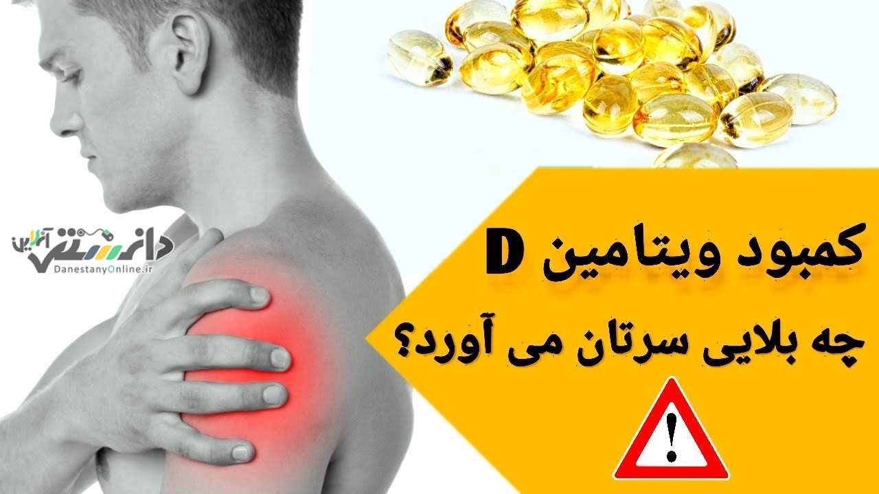 کمبود ویتامین D عامل پوکی استخوان است