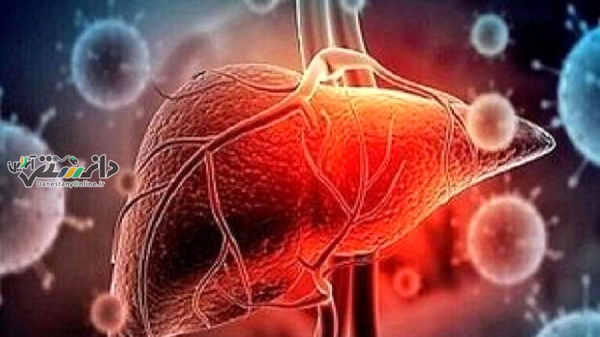 غذاهای مضر و خطرناک برای کبد