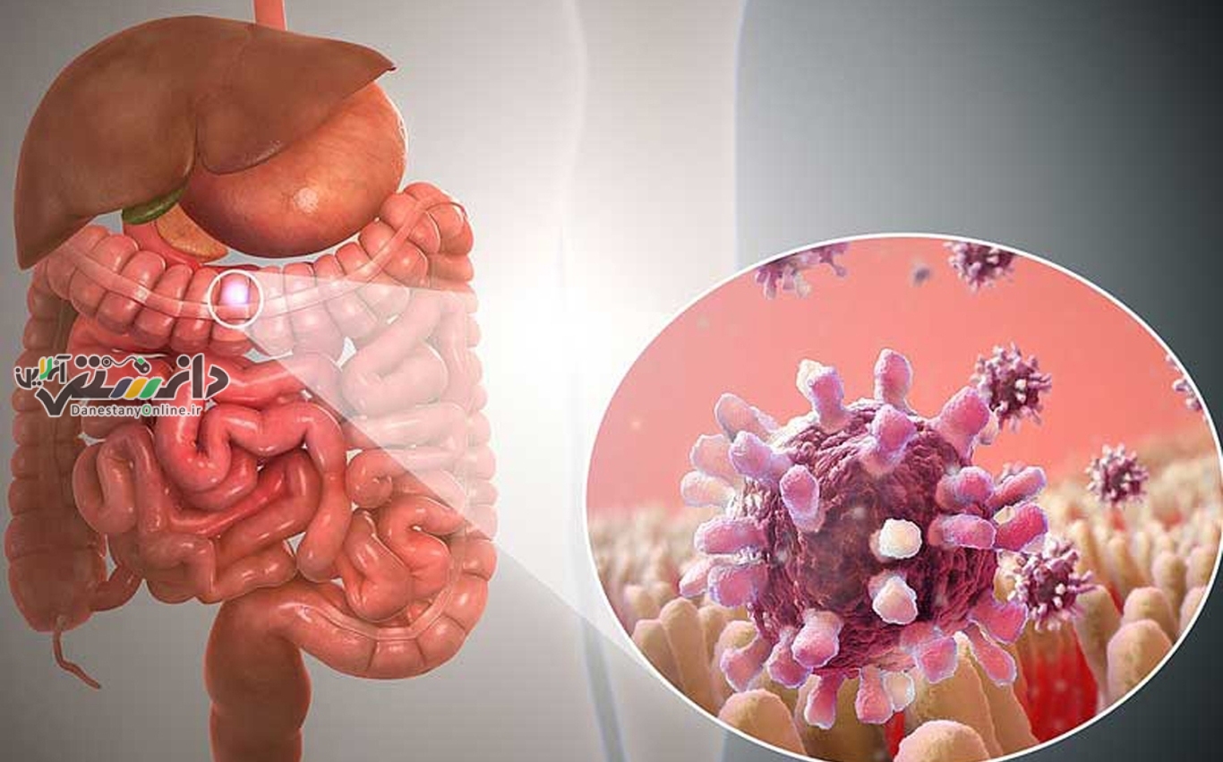 دانستنی سلامت/ معده هم به آنفلوآنزا مبتلا میشود؟