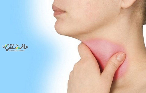 رژیم غذایی مبتلایان به اختلال تیروئید چه می باشد؟