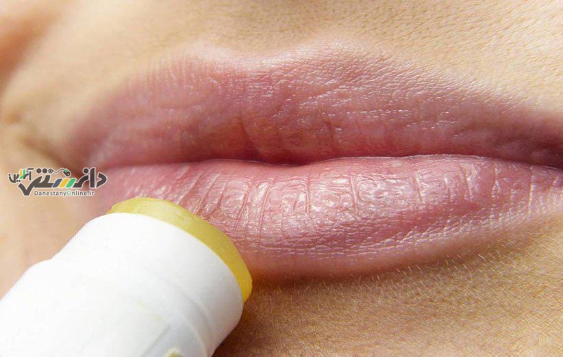 دانستنی سلامت/علائم ترک خوردگی لب