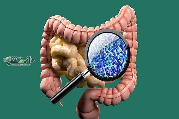 برای سلامت طبیعی روده بزرگ از این مواد استفاده کنید