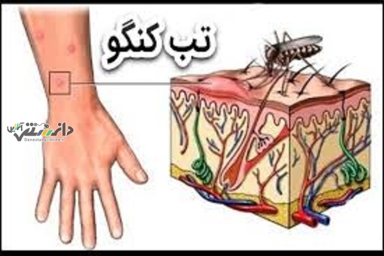 توصیههایی برای پیشگیری از تب کریمه کنگو+اینفوگرافیک
