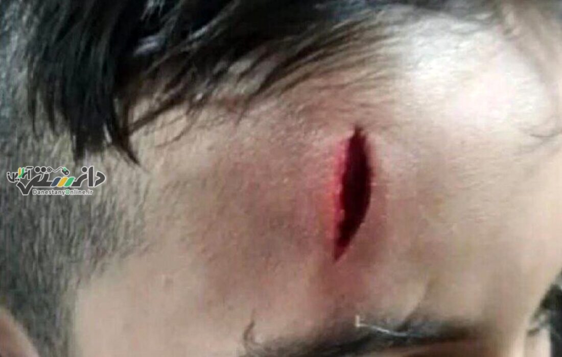 تنبیه بدنی معلم را از کار بیکار کرد