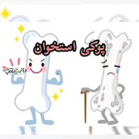 پوکی استخوان