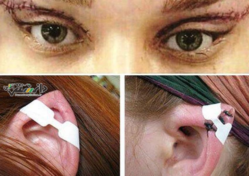 از عمل های جراحی «نصف کردن زبان» تا «گوش الاغی»