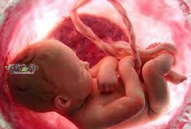 اولین جراحی مغز جهان روی یک نوزاد متولد نشده