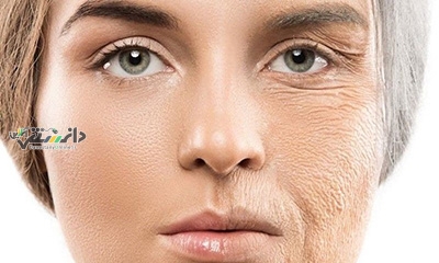 روشهایی برای بهبود خشکی پوست