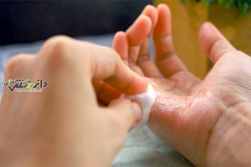 تکنیک های پاک کردن چسب یک دو سه (۱۲۳ قطره ایی) از سطوح و پوست