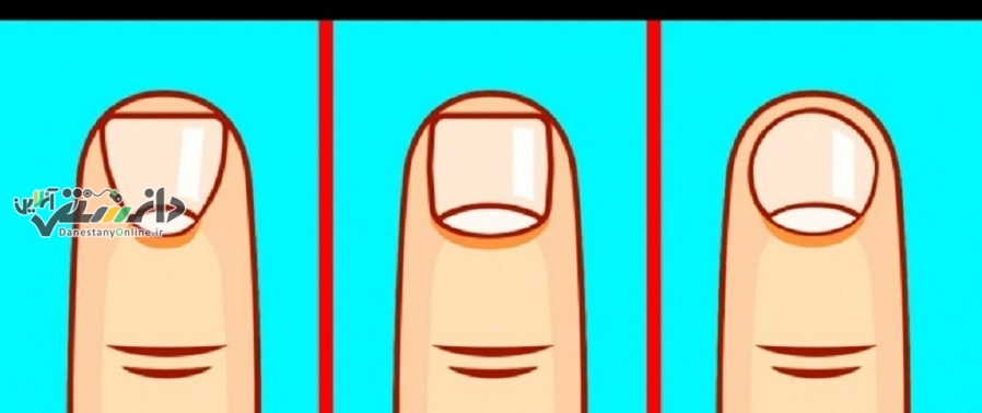 دانستنی روانشناسی/شخصیت شناسی از روی شکل ناخن