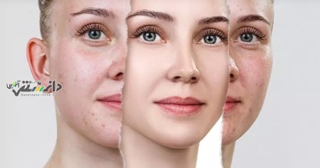 دانستنی پزشکی / کسانی که میخواهند رنگ پوستشان را تغییر دهند بخوانند