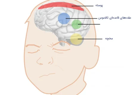 دانستنی سلامتی \چرا تیک عصبی میگیریم؟