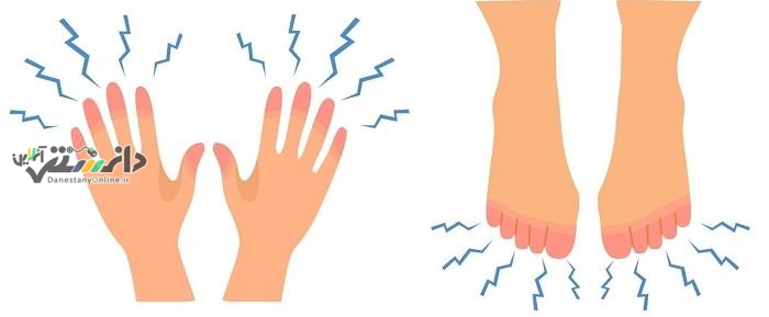 دانستنی سلامت/کمبود کدام ویتامین باعث گزگز شدن دست و پا می شود؟