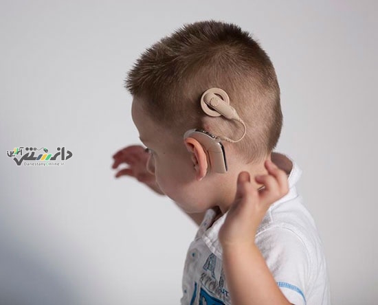 دانستنی اجتماعی/انجام بیش از ۲۰ هزار عمل کاشت حلزون شنوایی در کشور