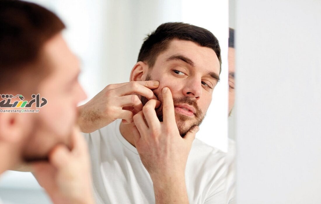 دانستنی علمی پزشکی/پنج مادهای که به مبارزه با آکنه کمک میکند