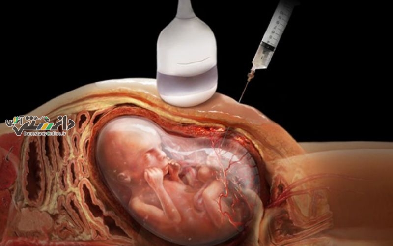 دانستنی سلامت/اجرای فراگیر غربالگری سلامت روان در دانشگاههای علوم پزشکی کشور