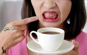 دانستنی سلامت/قهوه و سلامت دندان
