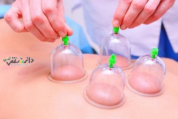 دانستنی بیماری/چه کسانی نباید در فصل بهار حجامت کنند؟