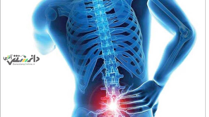 شناخت مهم ترین نشانه های ابتلا به دیسک کمر